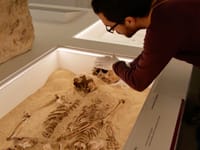 Scoperta la malattia genetica più antica del mondo: risale a 12 mila anni fa post image