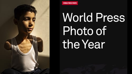 World Press Photo: l'orrore della guerra raccontato attraverso chi resta post image